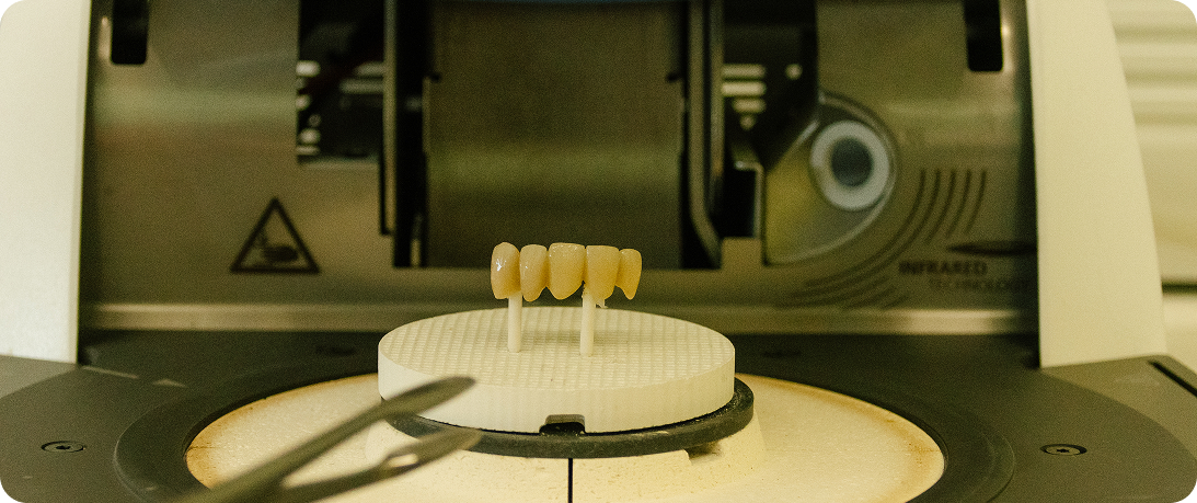 Protesis dental