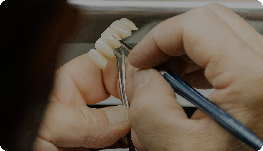 Diseño dentadura