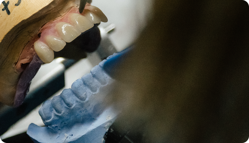 Diseño dentadura