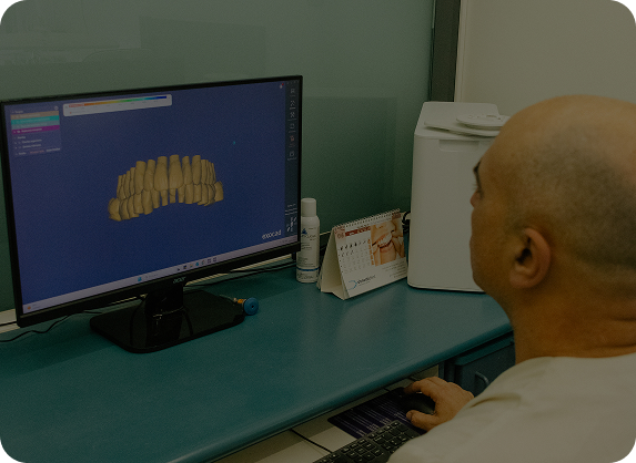Diseño CAD/CAM de dentadura
