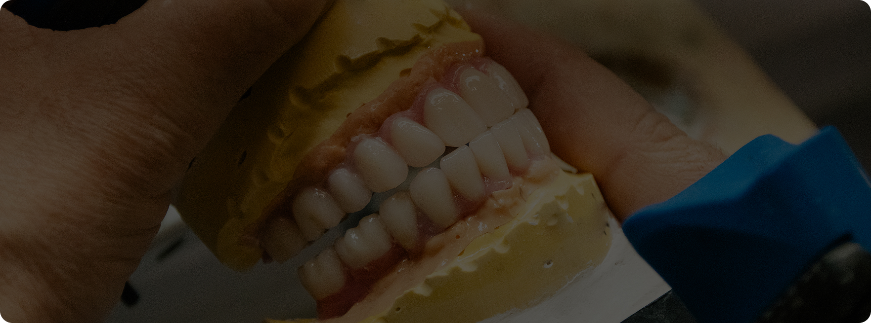 Laboratorio Dental, diseño dentadura