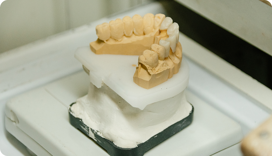 Protesis dental